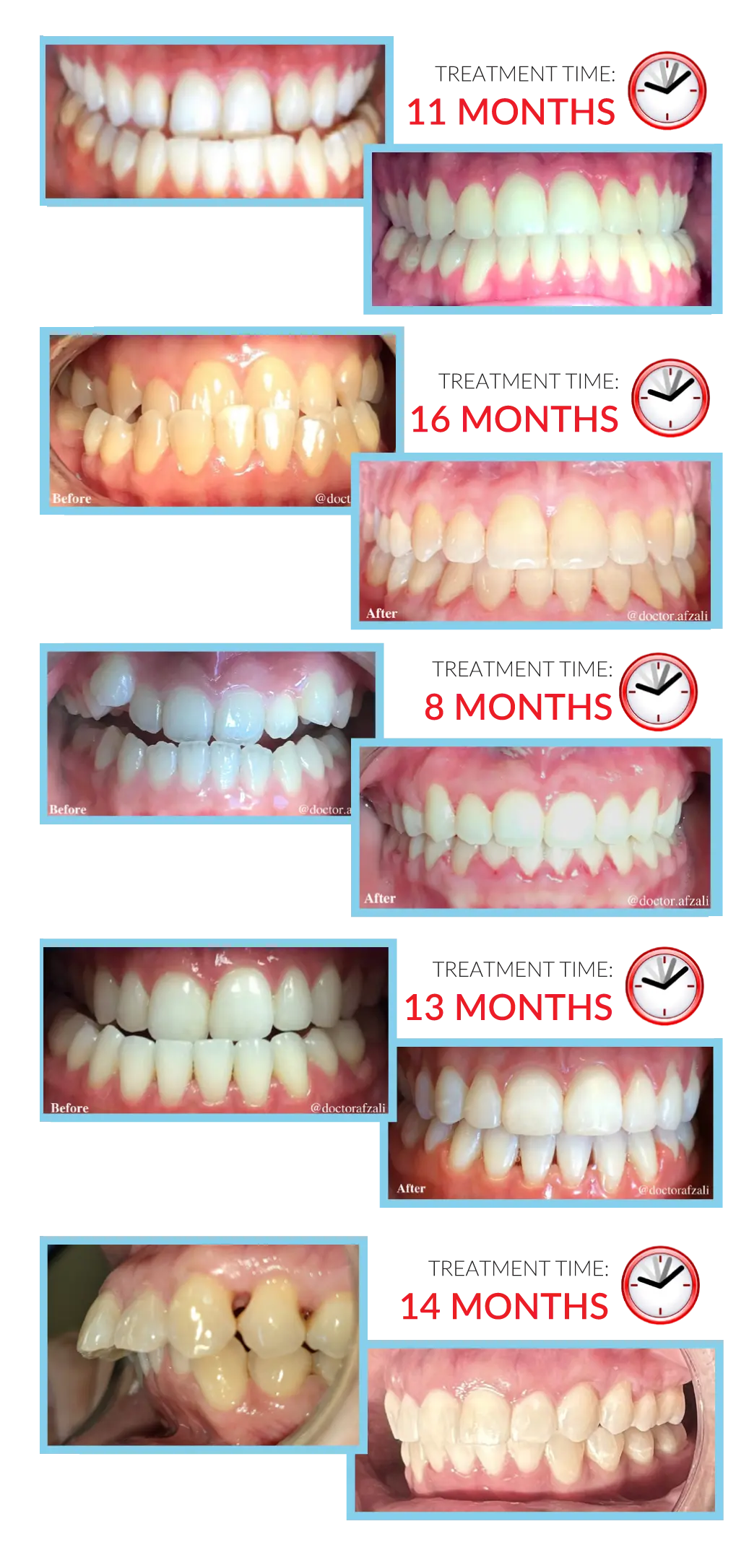 lifetime dental and fastbraces patient results